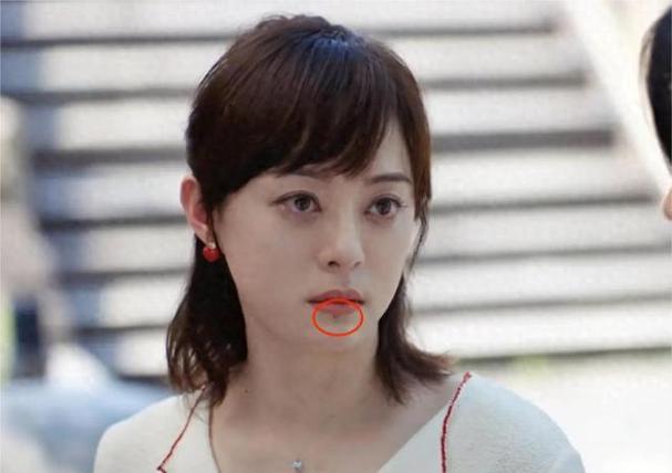 新澳门2025今晚开什么和孙俪唇下痣没了与孙俪嘴唇的痣