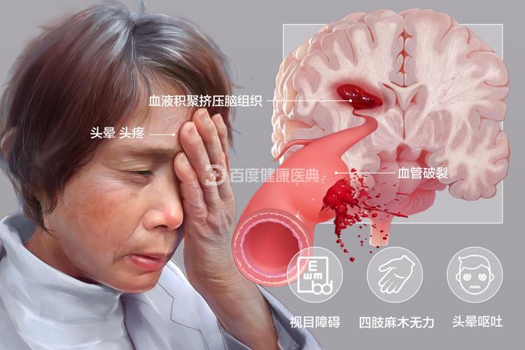 今晚澳门特马开奖结果和歌手突发脑溢血去世与著名歌唱家脑溢血